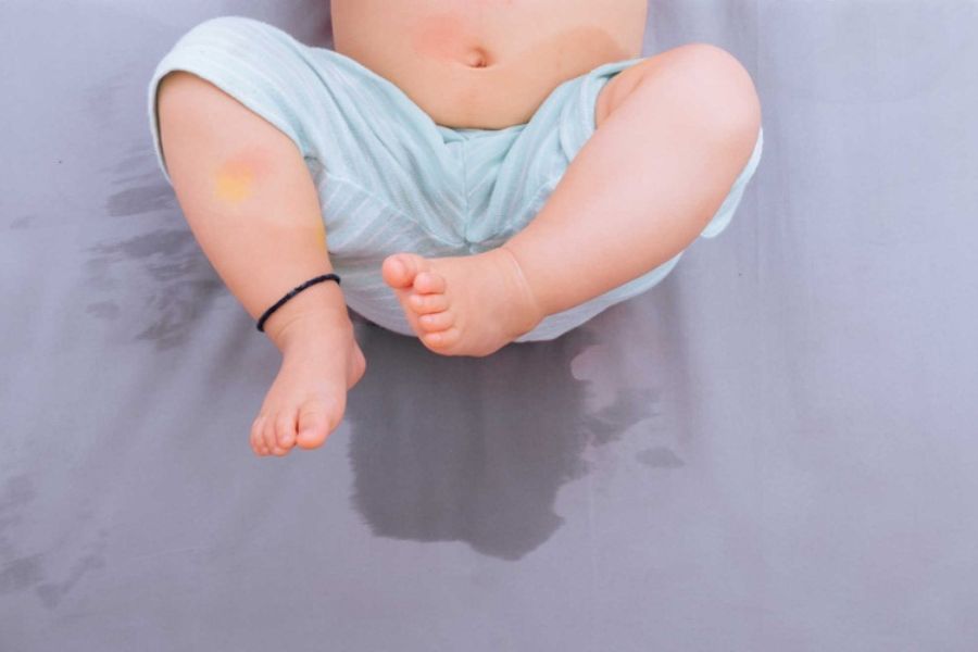 Em bé tè dầm hoặc mùi cơ thể cũng gây mùi hôi