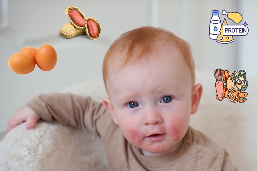 Một số loại thực phẩm như hải sản, trứng gây dị ứng ở bé 2 tuổi