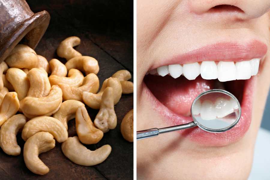 Hạt điều giàu canxi và phốt pho giúp răng chắc khỏe khi ăn.