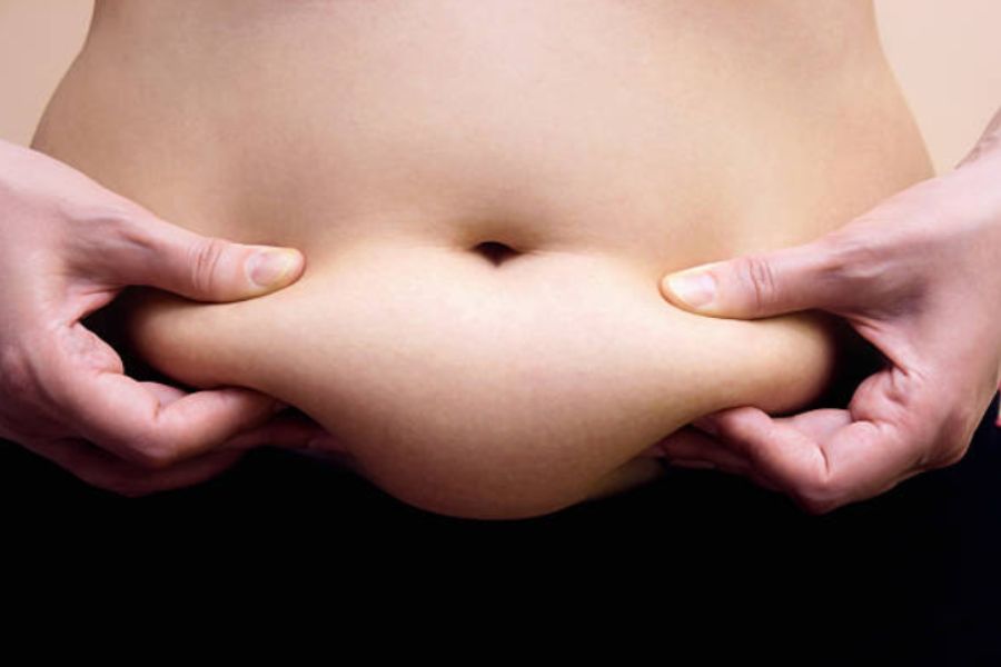 Mỡ thừa là nguyên nhân chính gây ra thừa cân, béo phì.