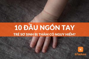 10 đầu ngón tay trẻ sơ sinh bị thâm