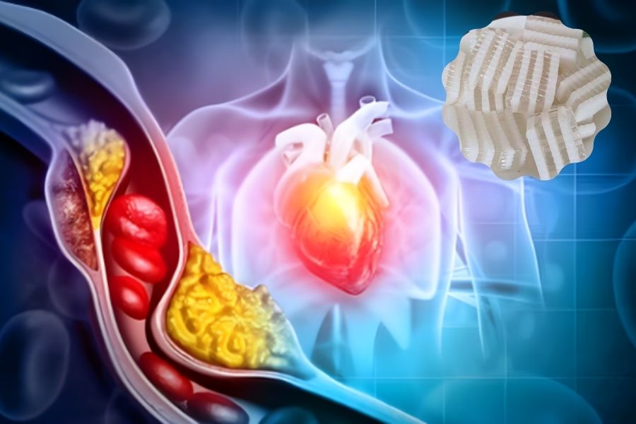 Rau câu dừa giúp giảm lượng cholesterol xấu trong cơ thể.