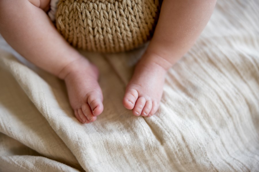 Ngoài 10 đầu ngón tay trẻ sơ sinh bị thâm sẽ còn xuất hiện ở những bộ phận khác.